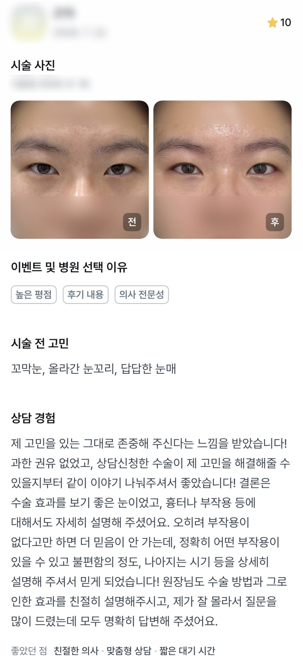디엠 빵트임/트임성형 후기, &ldquo;과한 권유 없고 친절하게 설명해주셨어요!&rdquo; 관련 이미지 1