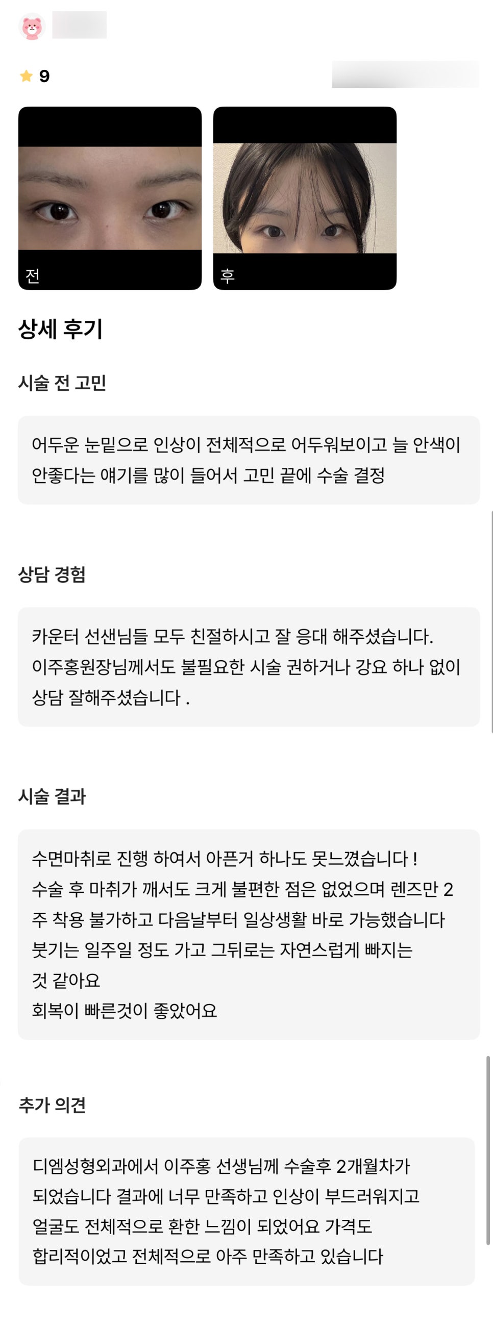눈밑지방재배치 후기." 인상이 부드러워지고 얼굴도 전체적으로 환한 느낌이 되었어요!" 관련 이미지 1