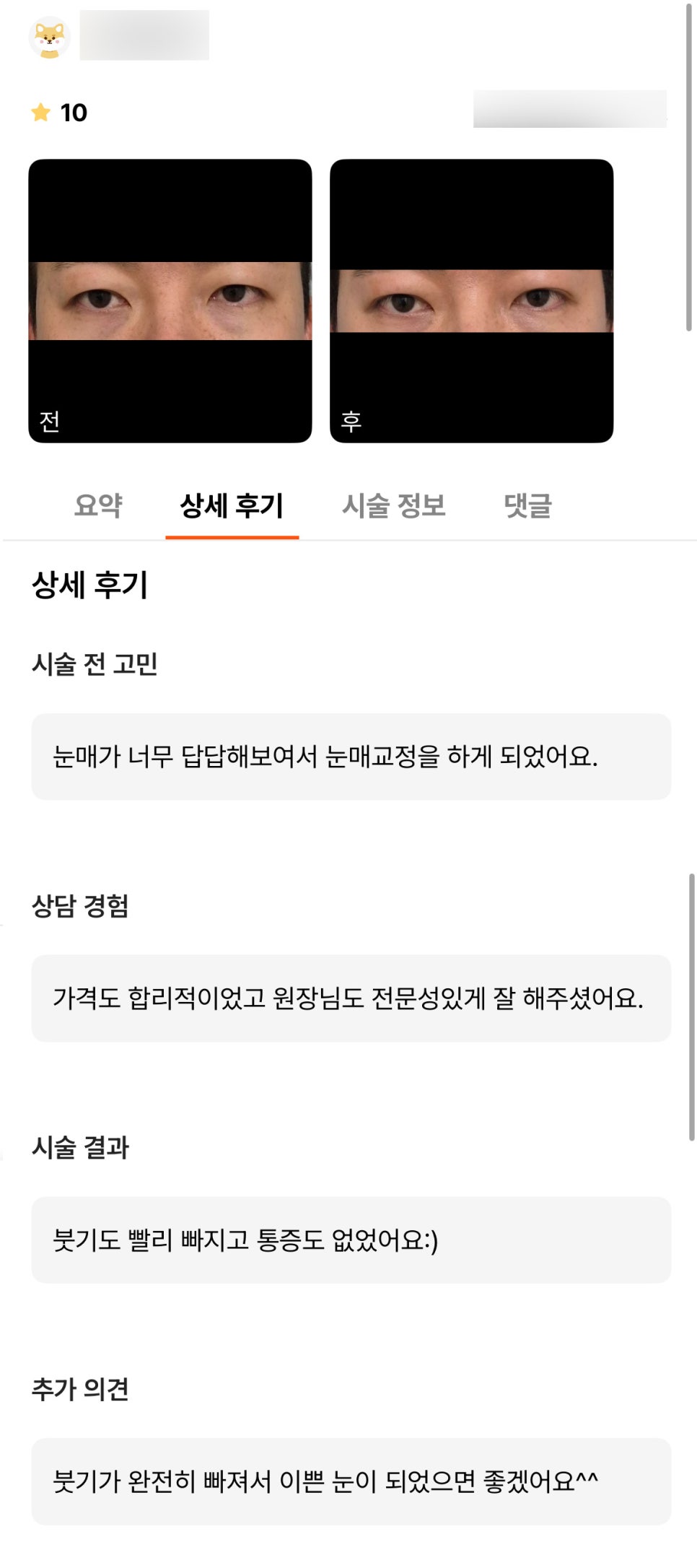 눈성형 후기."붓기도 빨리 빠지고 통증도 없었어요 :) " 관련 이미지 1