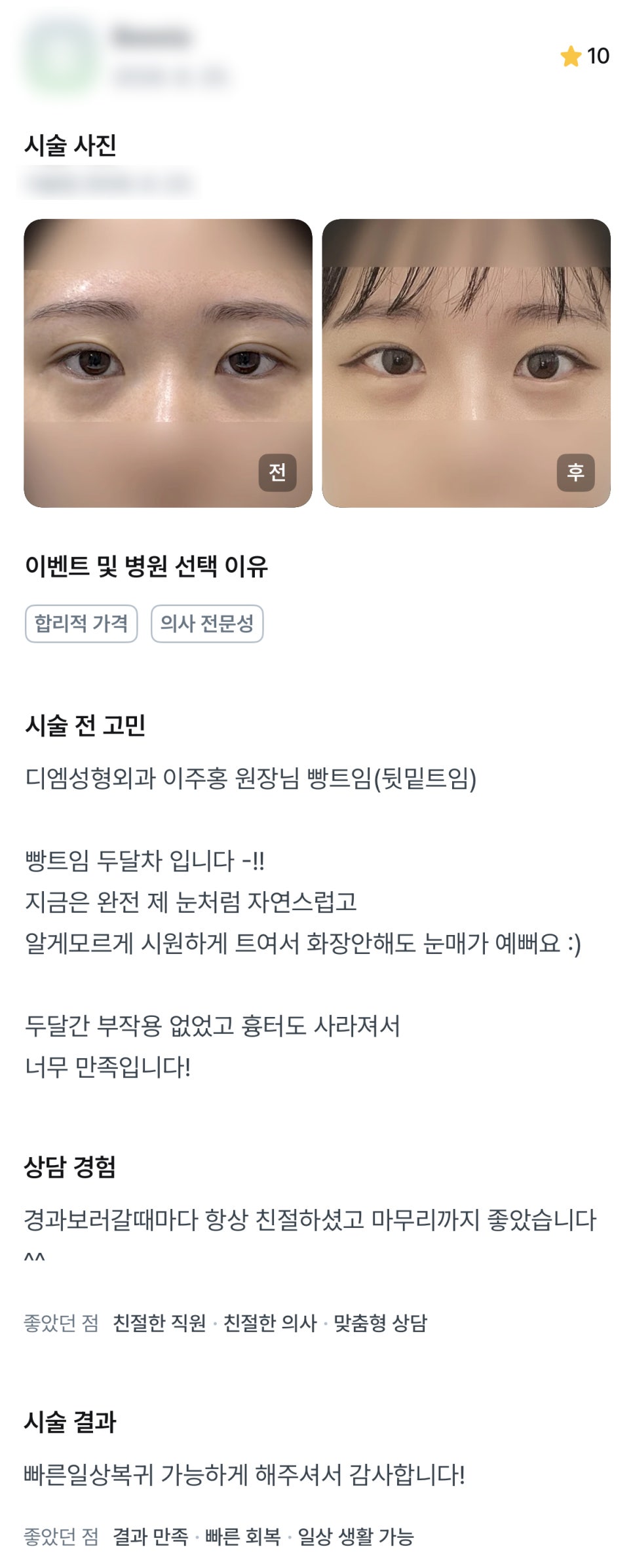 디엠 트임재수술 후기, &ldquo;알게 모르게 시원하게 트여서 눈매가 예뻐요!&rdquo; 관련 이미지 1