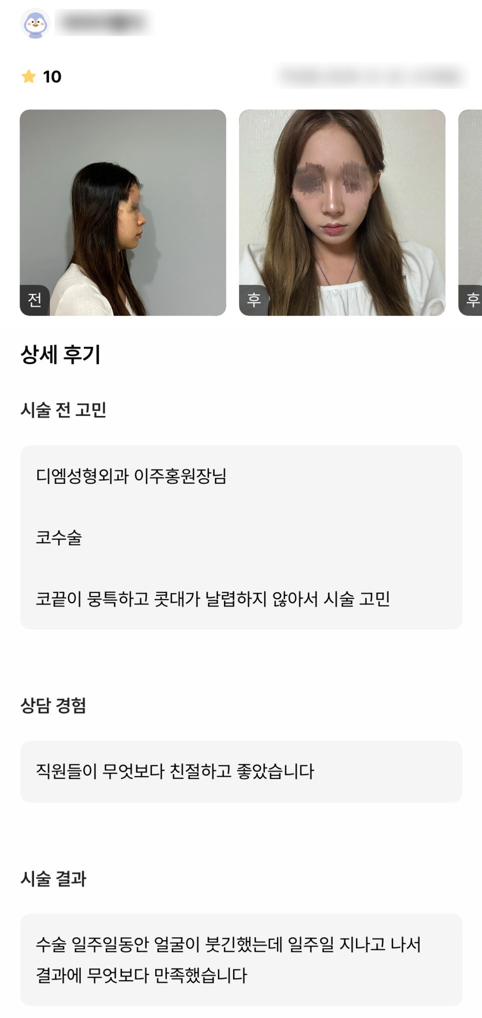 디엠 코성형 후기, “무엇보다 결과에 만족했습니다!” 관련 이미지 1