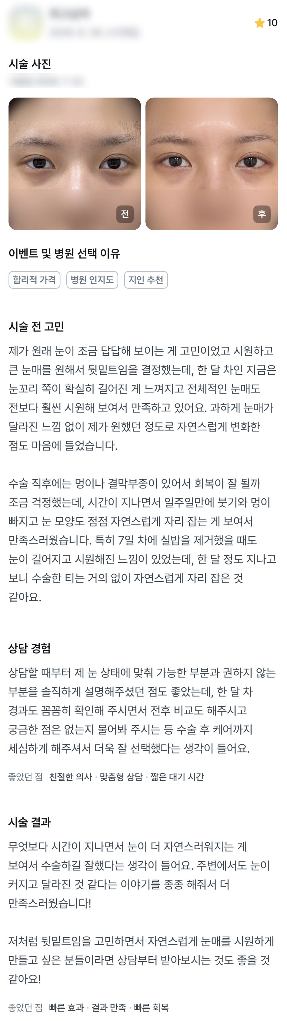 디엠 뒤밑트임/트임성형 후기, “전보다 훨씬 시원해 보여서 만족하고 있어요!” 관련 이미지 1