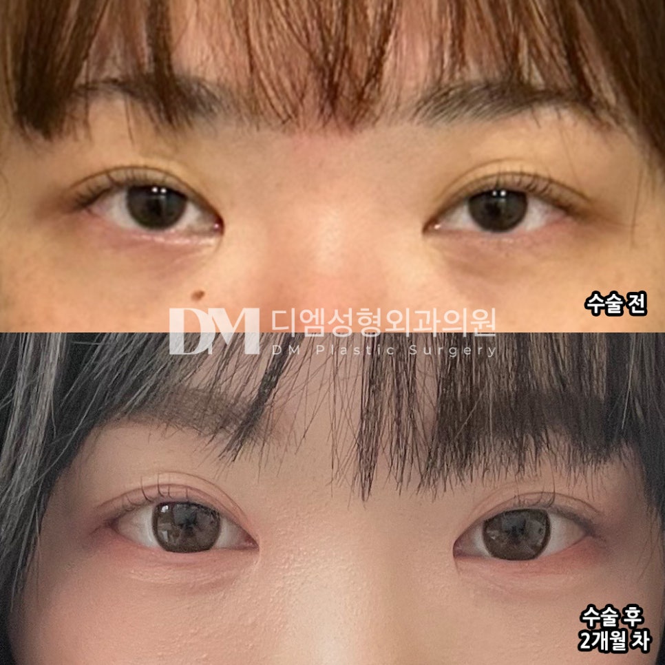 빵트임 후기."티 안나게 자연스럽게 된 거 같아 만족합니당" 관련 이미지 2