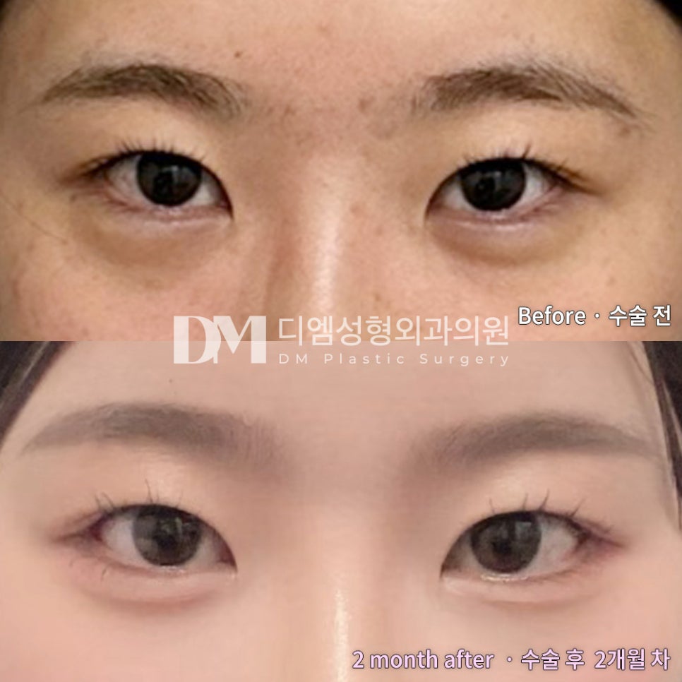 빵트임 후기."진짜 고민 엄청 많이 했는데 잘했다는 생각 밖에 안들어요!!" 관련 이미지 2