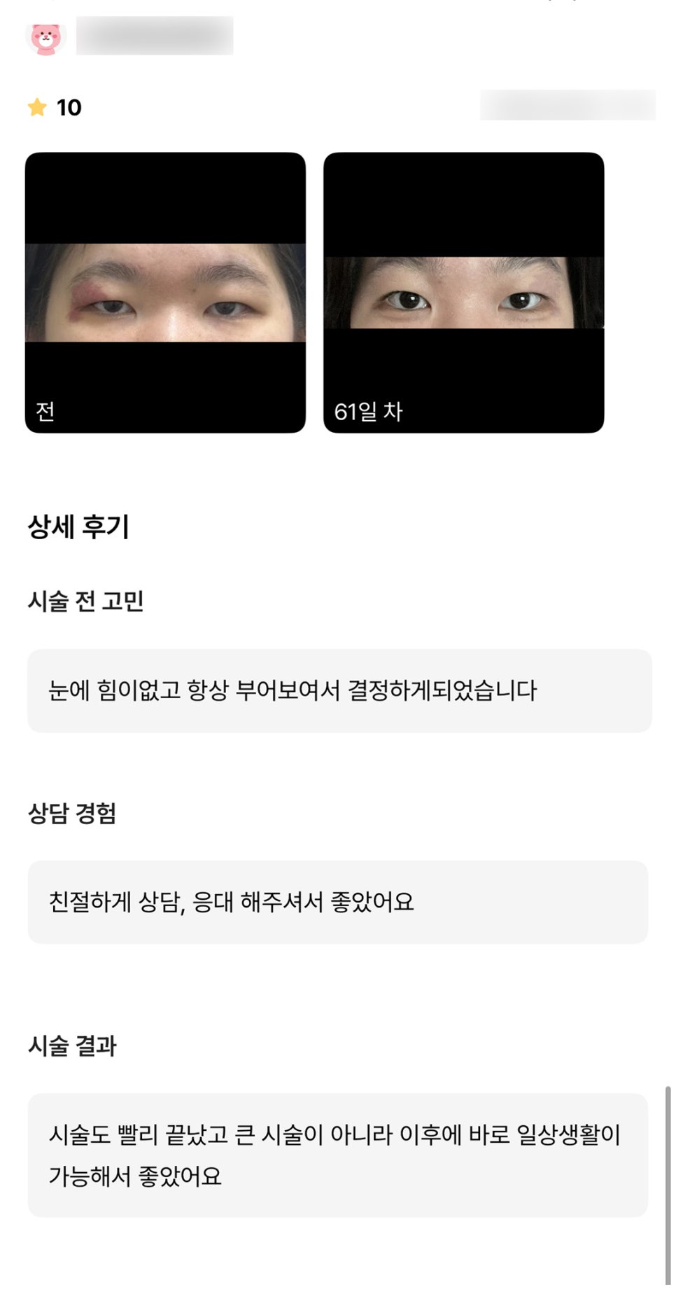 Blepharoplasty Review. "I liked that it was a procedure that allowed me to return to daily life right away!" image 1