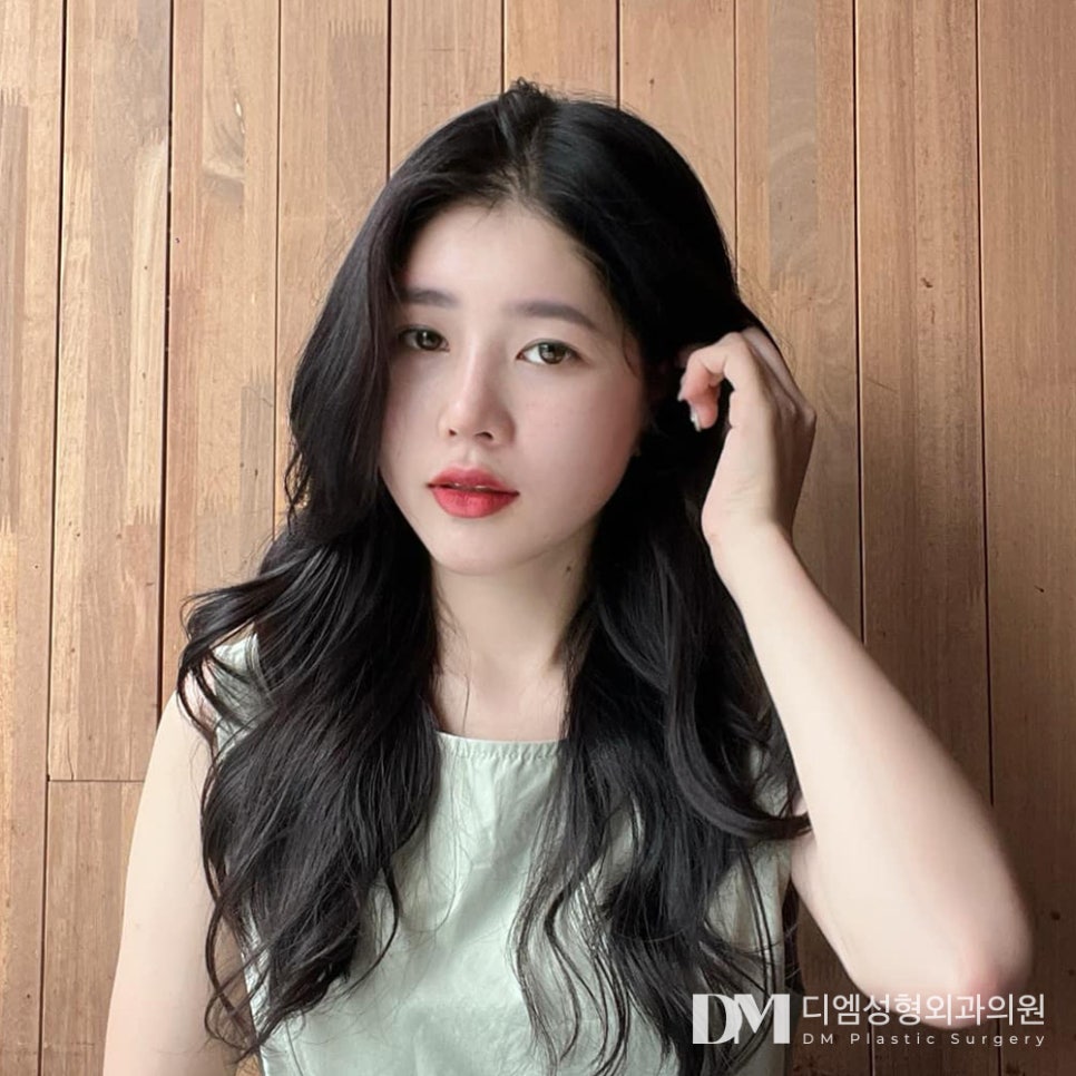 이마거상, 이마처짐으로 인한 불편함 개선하기 관련 이미지 1
