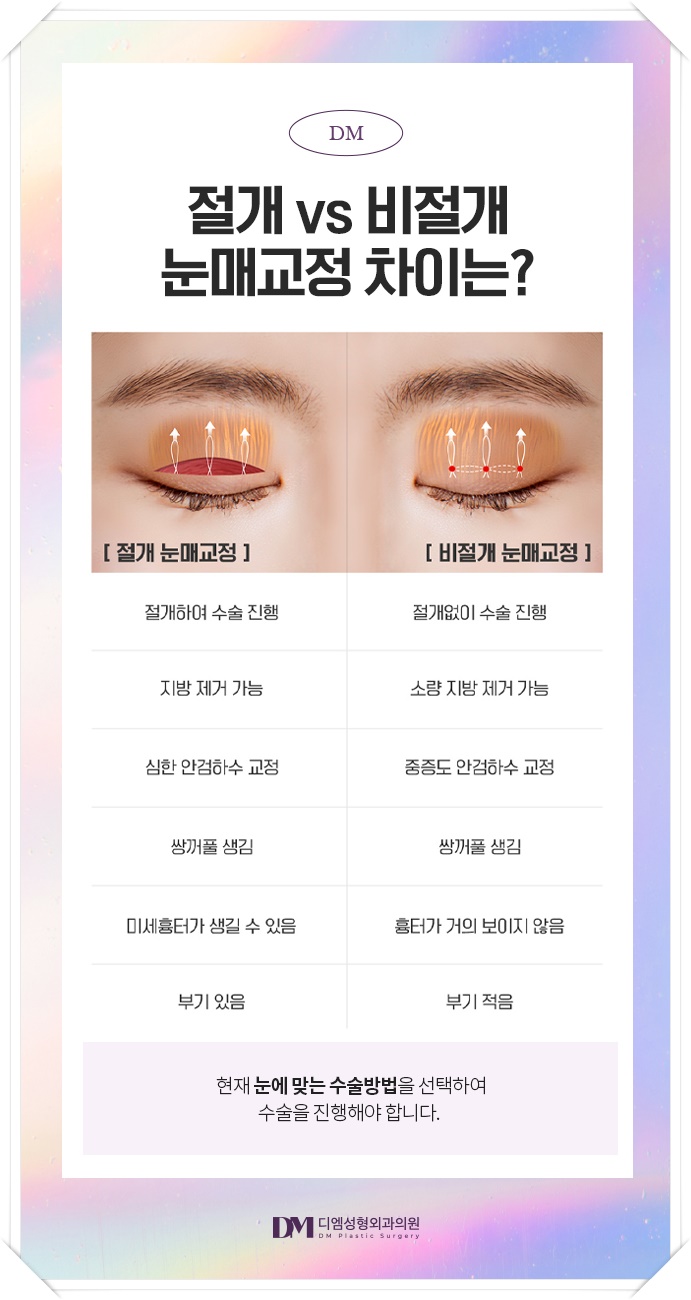 눈매교정, 피곤해보이는 인상 탈출하기 관련 이미지 7