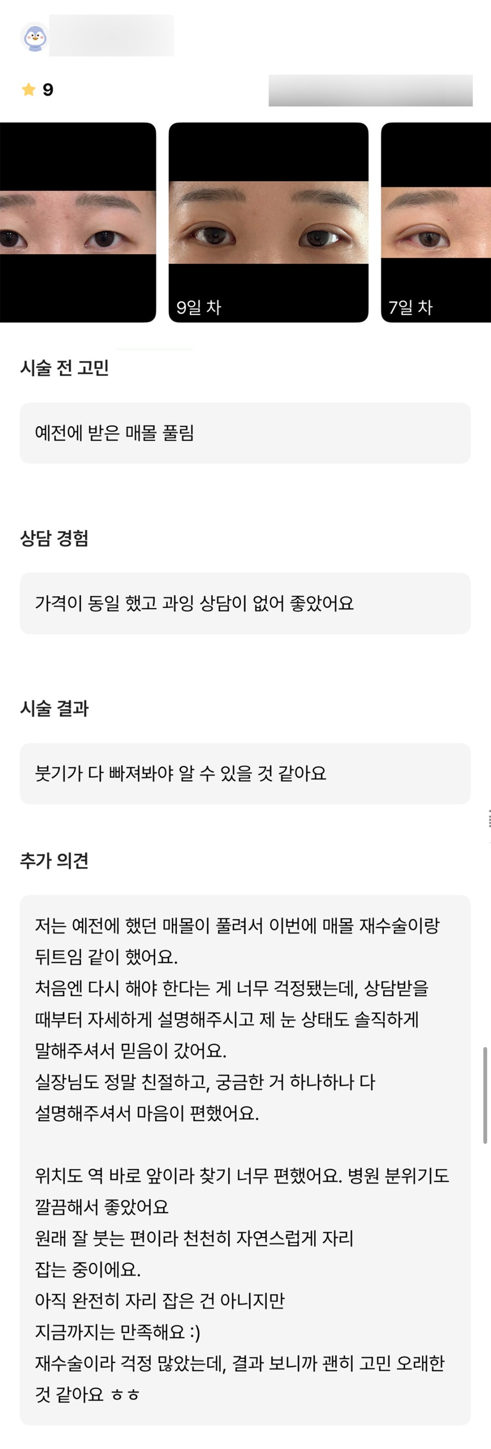 Eye Surgery Review. “I was worried because it was a revision surgery, but looking at the results, I think I worried for too long for nothing haha” image 1