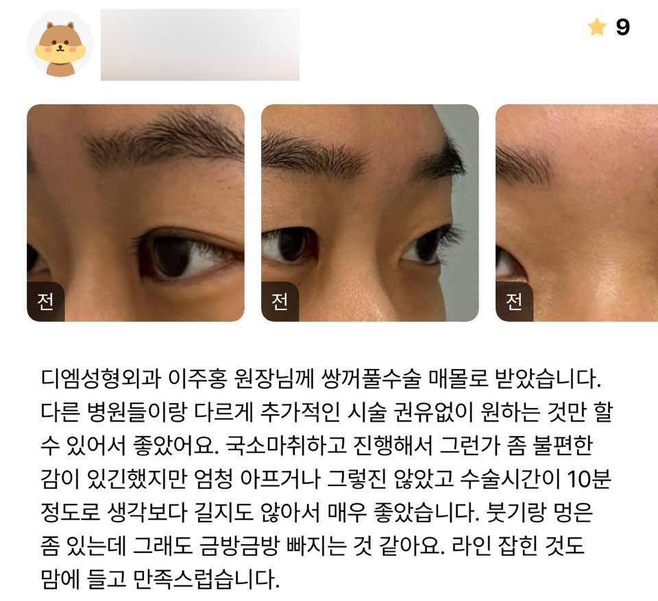 눈성형 후기."라인도 마음에 들고 만족스러워요!" 관련 이미지 1