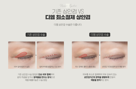 Escape Drooping Eyes and Renew Your Eye Area for a More Youthful Look image 6