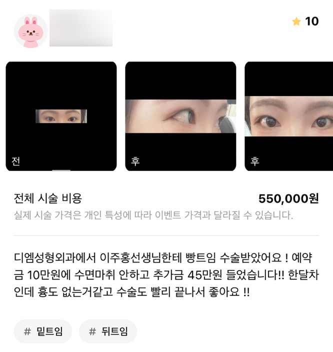 Ppangtteum Review. "It’s been a month, and I’m glad there’s no scar and the surgery finished quickly!" image 1