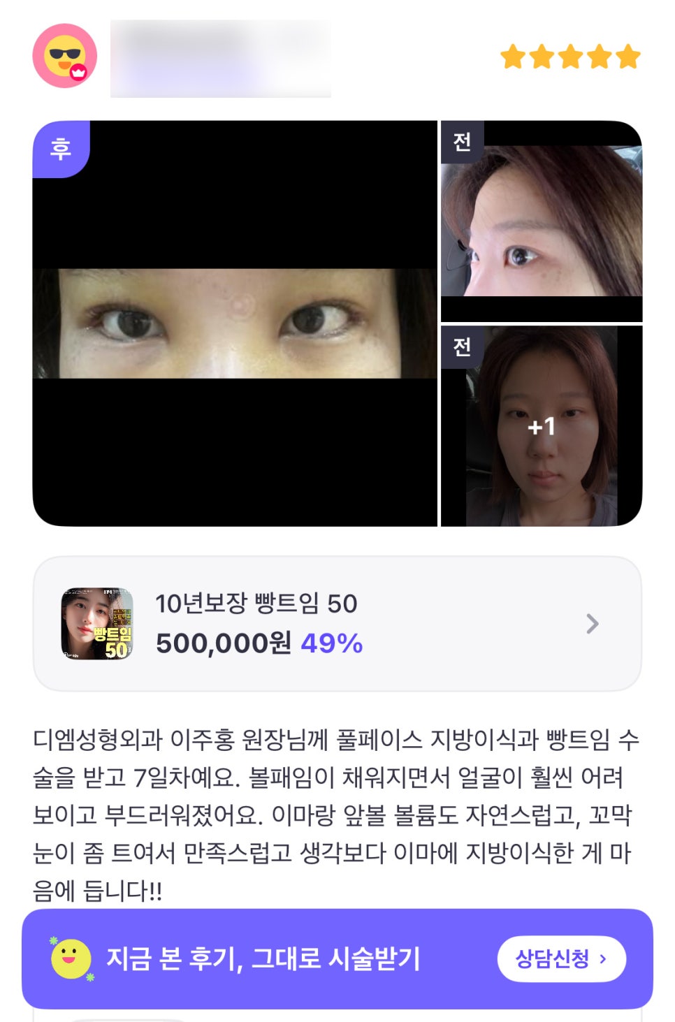 빵트임 후기."꼬막눈이 좀 트여서 만족스러워요!" 관련 이미지 1