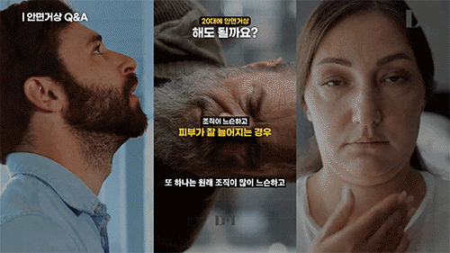 안면거상 나이, 몇 살에 하는 게 가장 효과적일까요? 관련 이미지 6