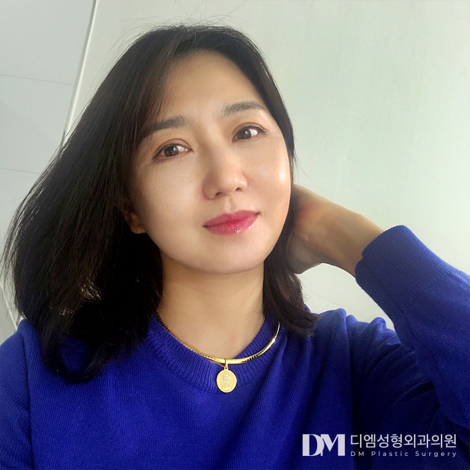 시야를 방해하는 처진 눈두덩이가 고민이라면? 관련 이미지 13