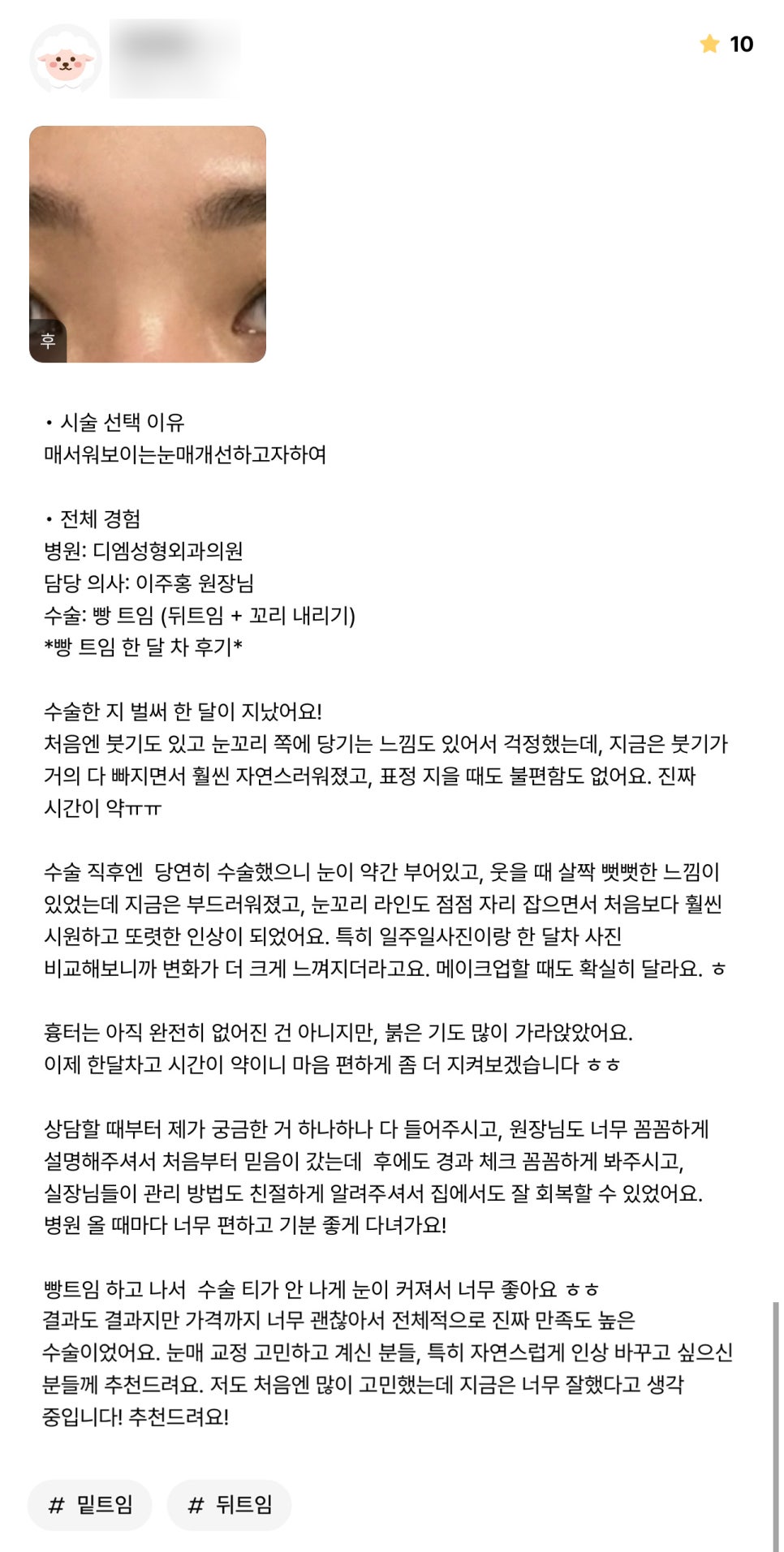빵트임 후기."자연스럽게 인상 바꾸고 싶으신 분들께 추천드려요!" 관련 이미지 1