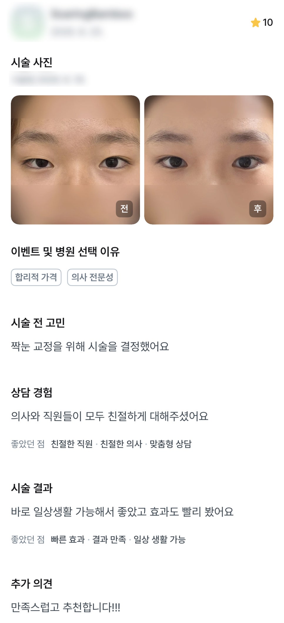 디엠 쌍꺼풀/눈성형 후기, “만족스럽고 추천합니다!” 관련 이미지 1