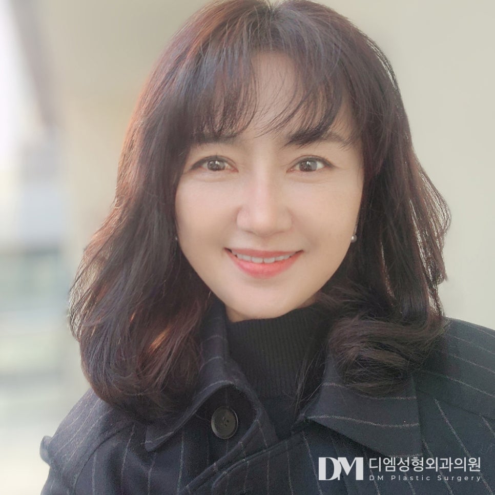 디엠 안면거상 전후사진, 잃어버린 젊음을 되찾을 수 있는 리프팅 관련 이미지 4