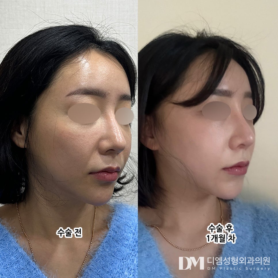 반거상 후기."피부가 탄탄해지고 얼굴선이 정리된 느낌이에요!" 관련 이미지 2