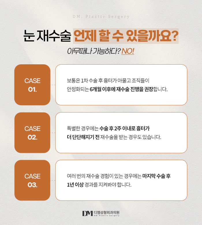 눈재수술, 쌍꺼풀이 풀려 비대칭 눈매가 되었다면? 관련 이미지 9