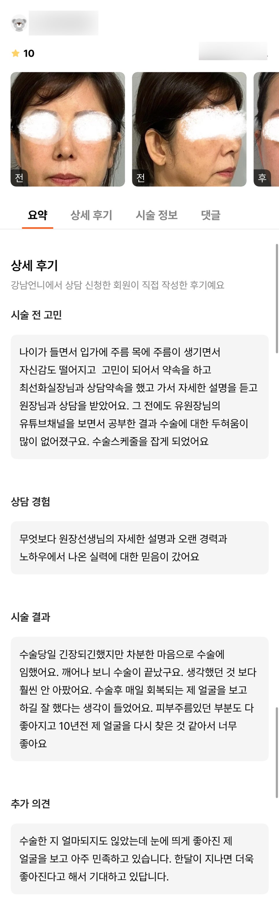 안면거상 후기."눈에 띄게 좋아져 아주 만족해요!" 관련 이미지 1