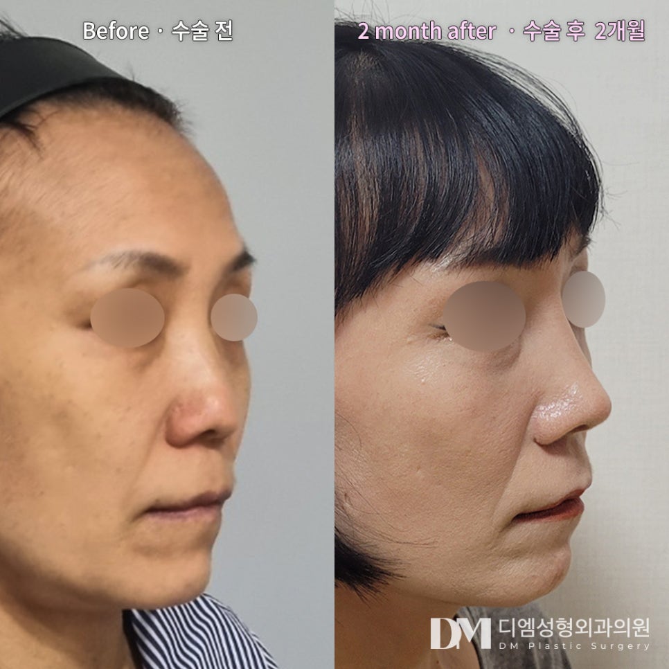 A short nose should not be lengthened unconditionally! image 8