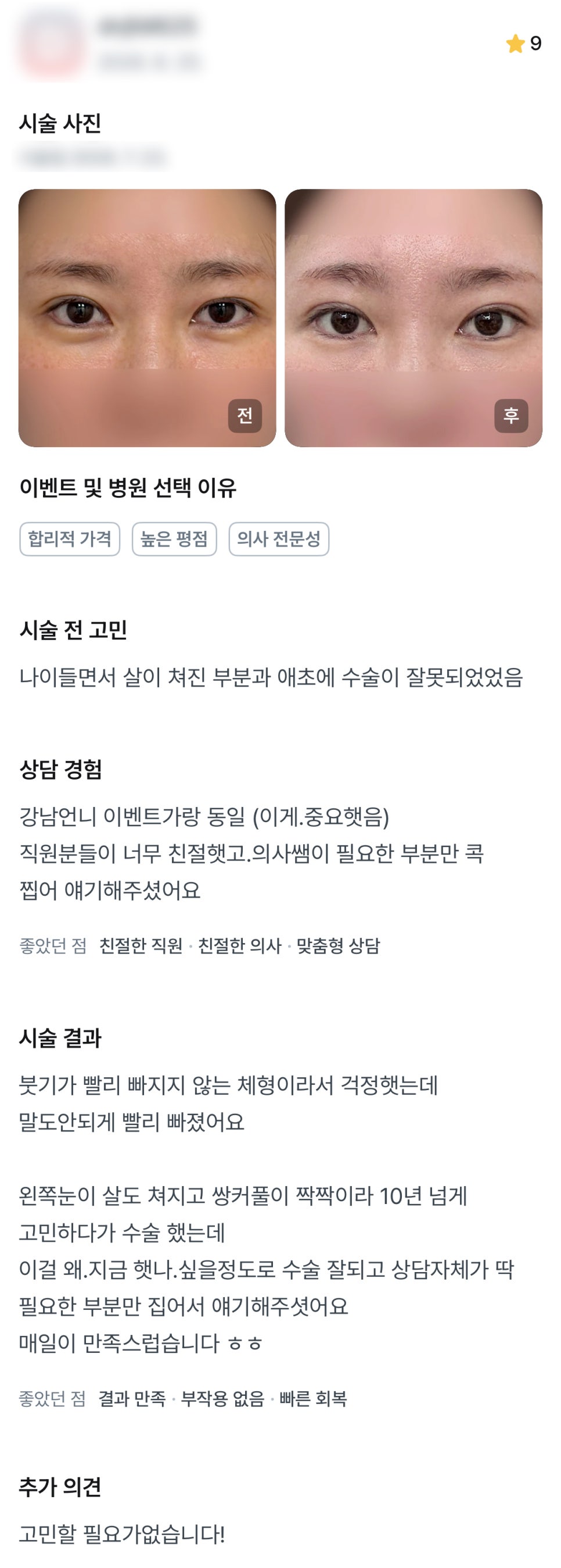 디엠 눈재수술 후기, &ldquo;매일이 만족스럽습니다!&rdquo; 관련 이미지 1