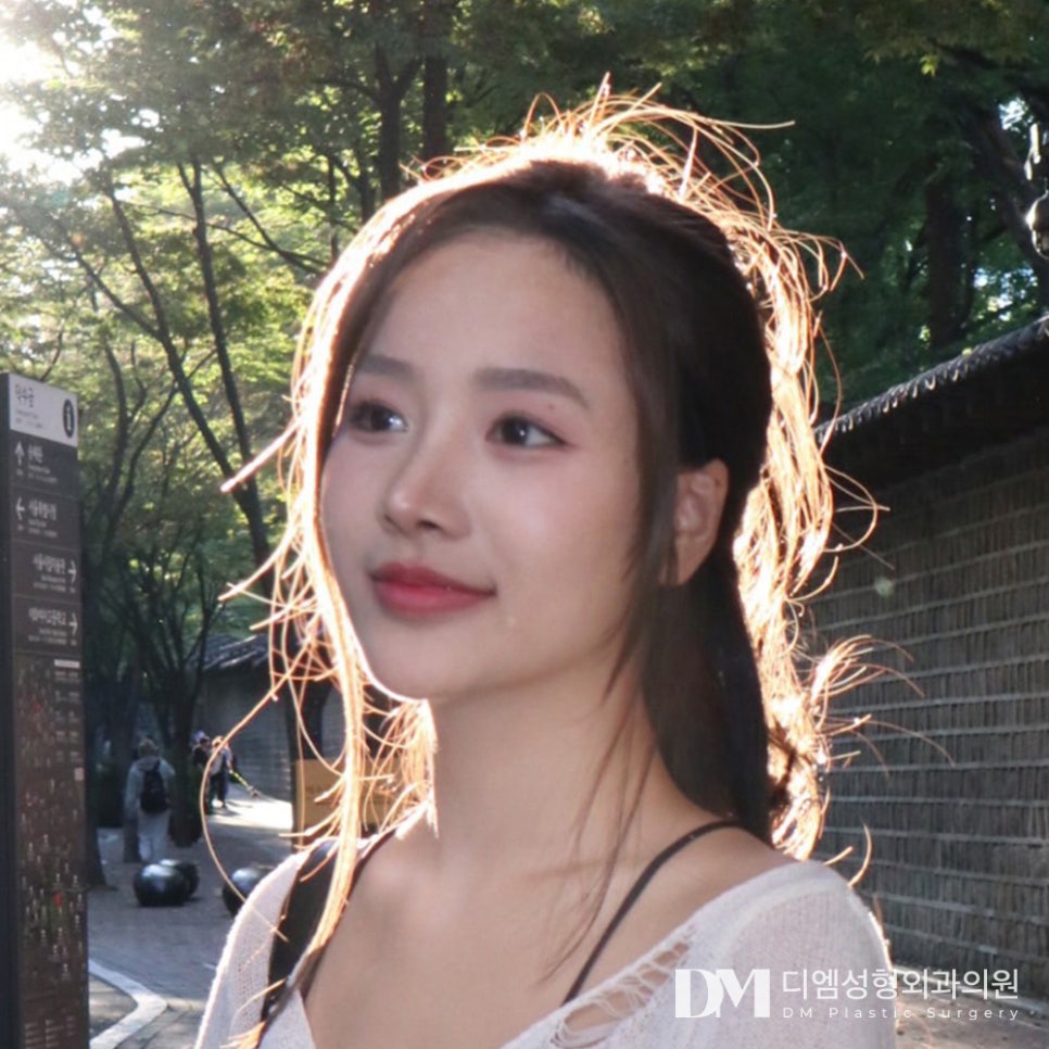 복코성형, 세련된 코와 인상 만들기 관련 이미지 1