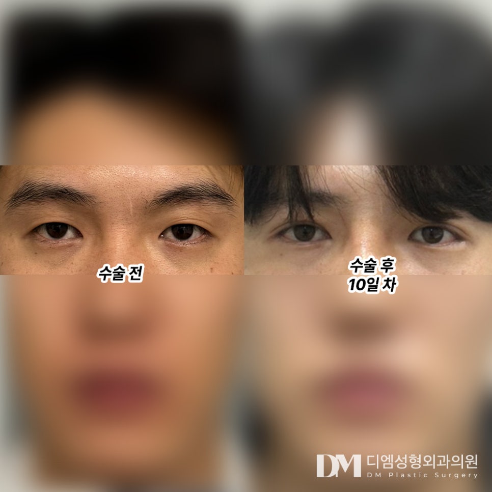 Eye Surgery Review: “Everyone was so kind, and I’m happy that the surgery went well!” image 2