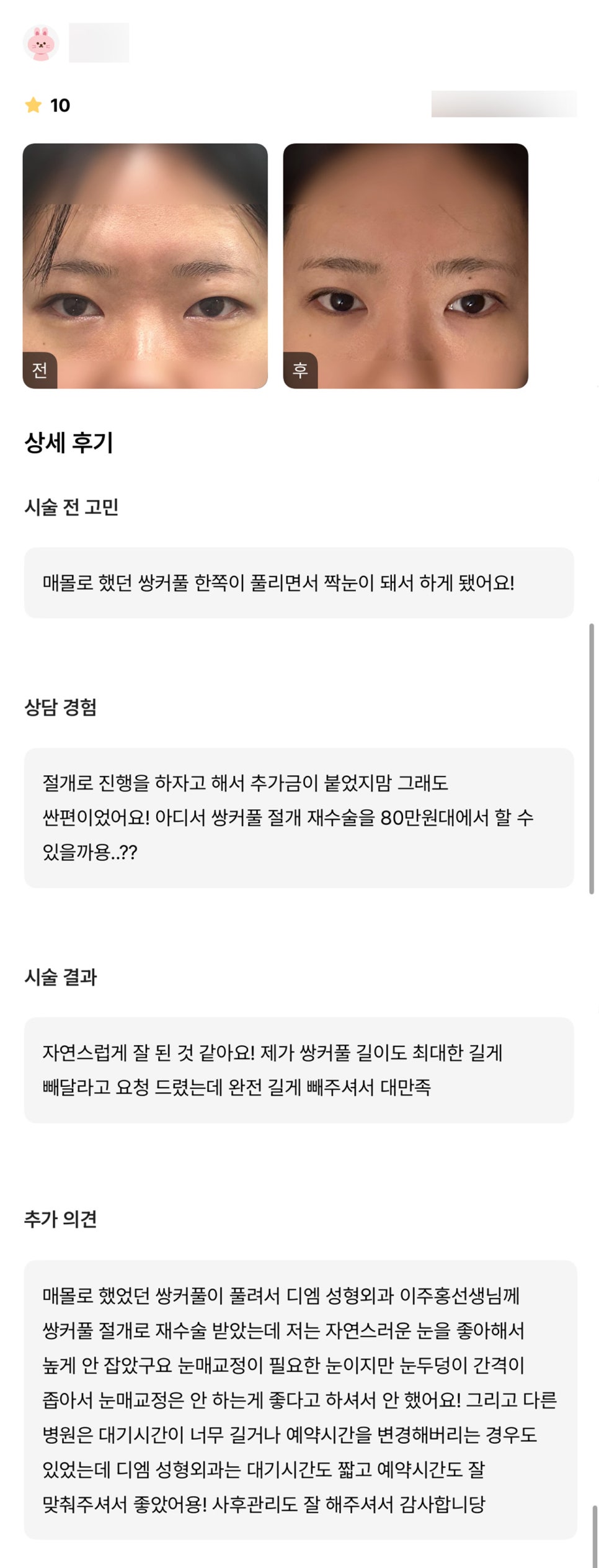 눈재수술 후기."자연스럽고 니즈에 맞춰 잘해주셔서 대만족!" 관련 이미지 1