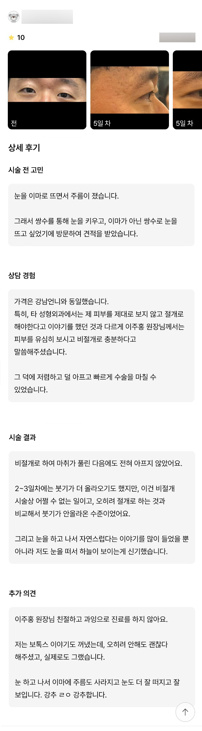 눈성형 후기."강추합니다!" 관련 이미지 1