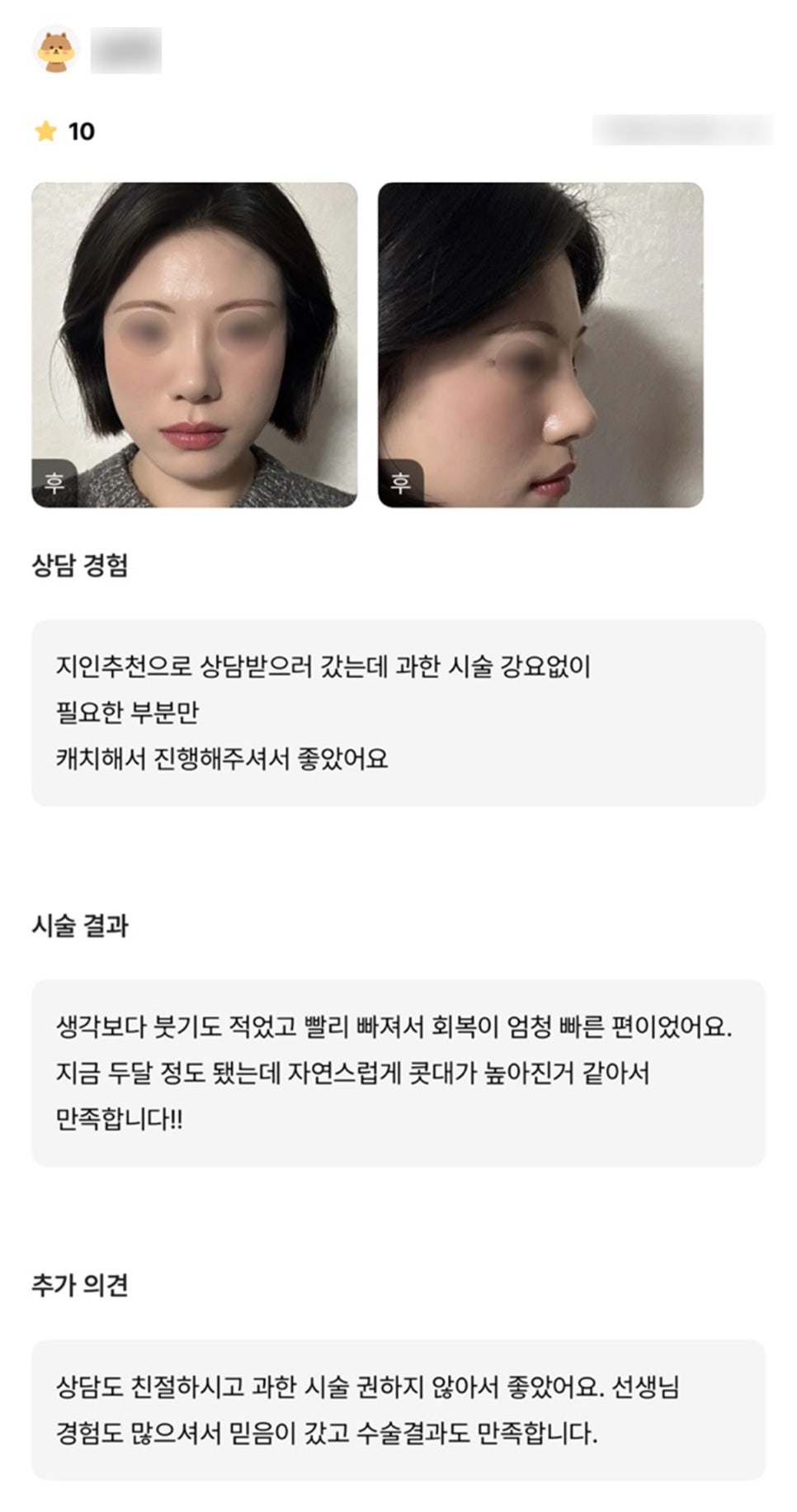 코성형 후기."자연스럽게 콧대가 높아진 것 같아서 만족합니다!" 관련 이미지 1
