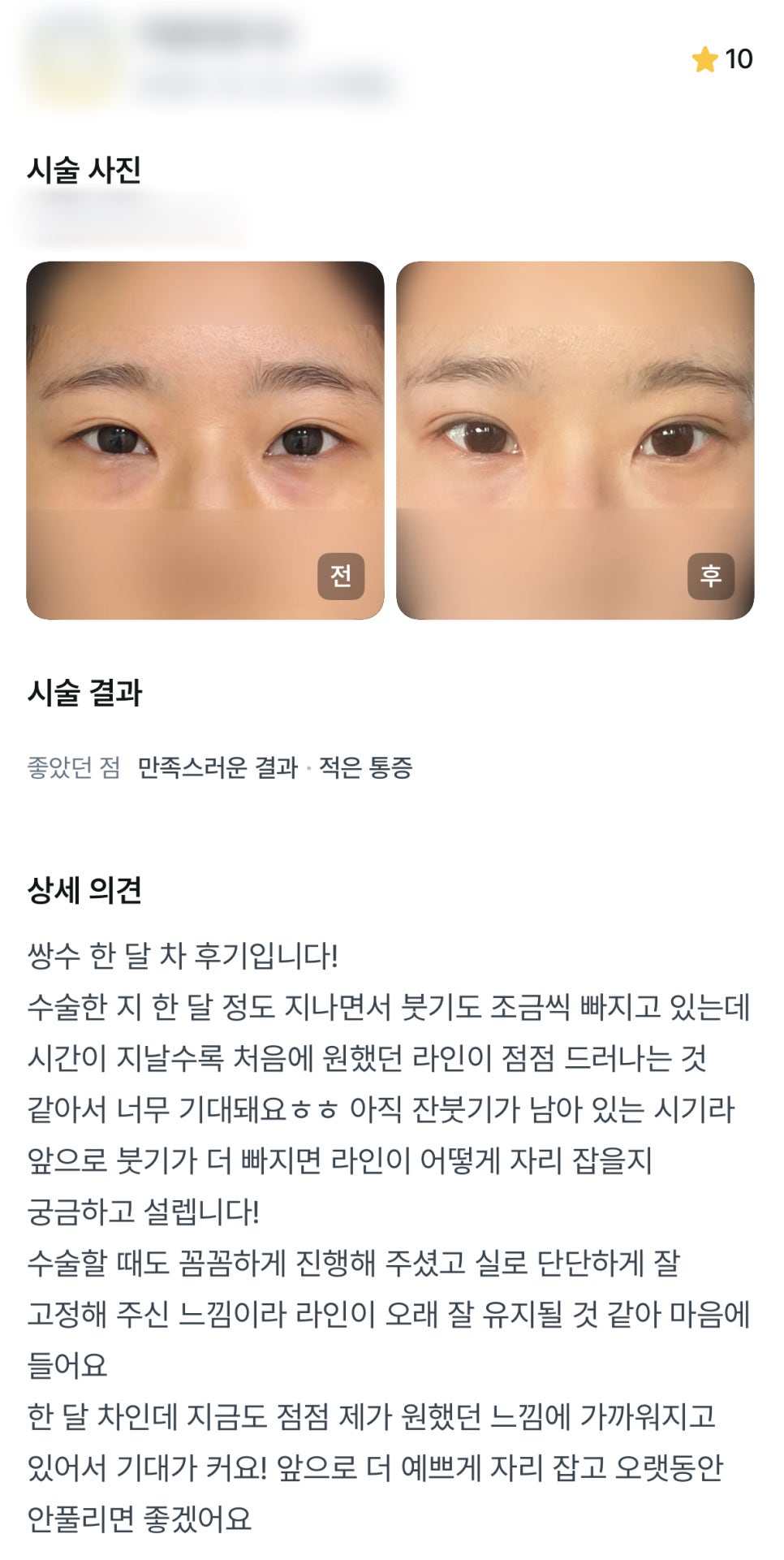 디엠 눈재수술/눈매교정 수술후기, “라인이 어떻게 자리 잡을지 궁금하고 설렙니다!” 관련 이미지 1