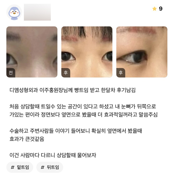 빵트임 후기."확실히 옆에서 봤을때 효과가 큰 것 같아요!" 관련 이미지 1