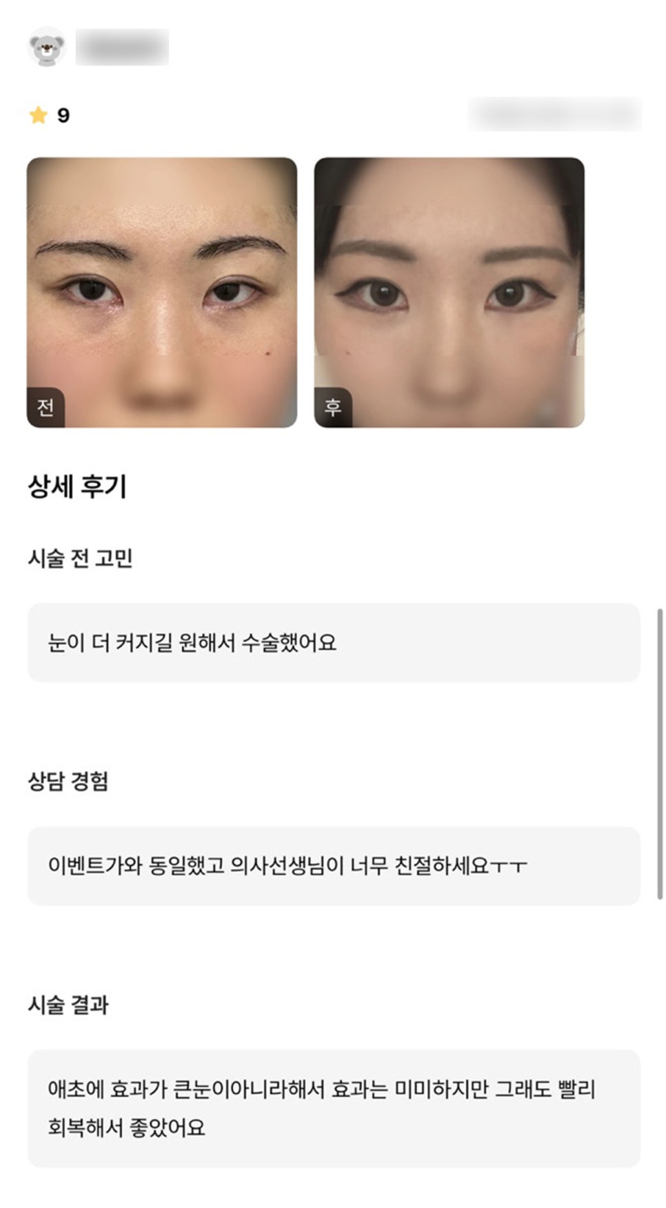 Bbangttim Review. "They were kind, and the recovery was fast, which I liked!" image 1