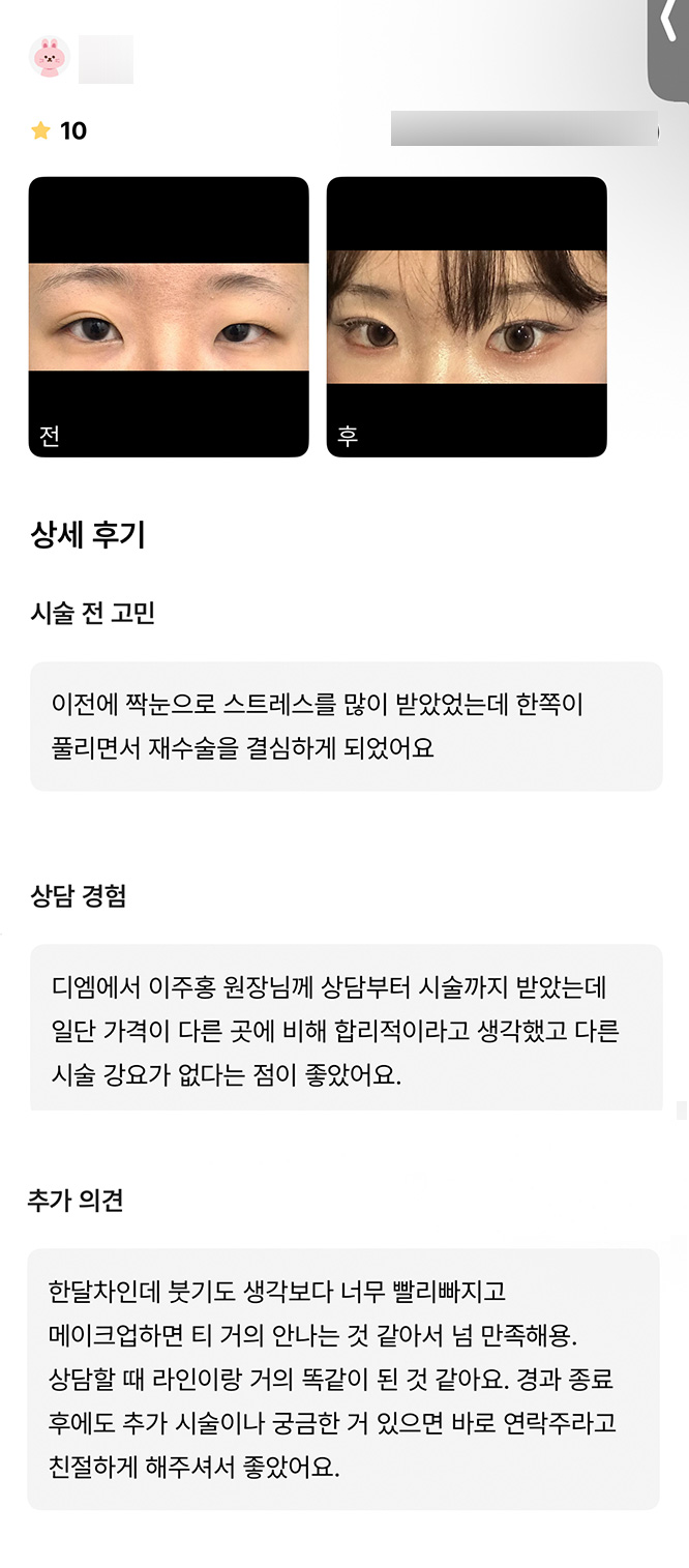 눈재수술 후기."메이크업하면 티 거의 안나서 만족해요!" 관련 이미지 1
