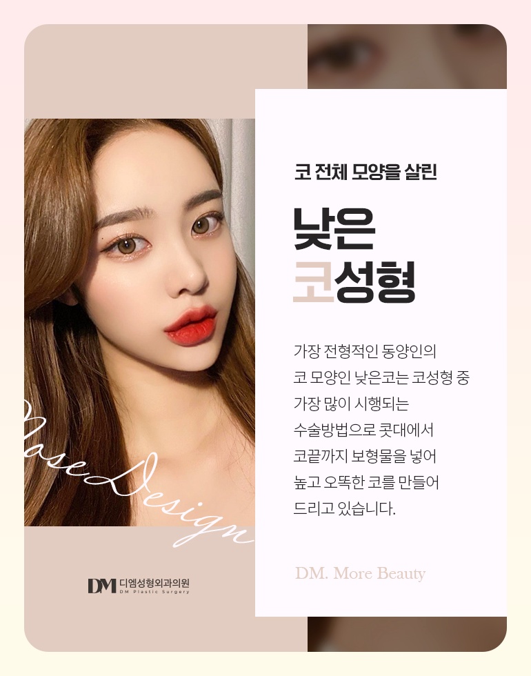 낮은코성형, 무조건 높은 코 보다는 내 이목구비에 맞게 ! 관련 이미지 4