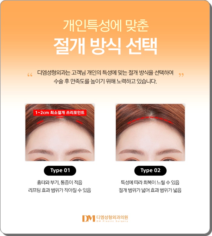 이마거상, 이마 주름과 처진 눈매를 한번에 교정하고 싶다면? 관련 이미지 5