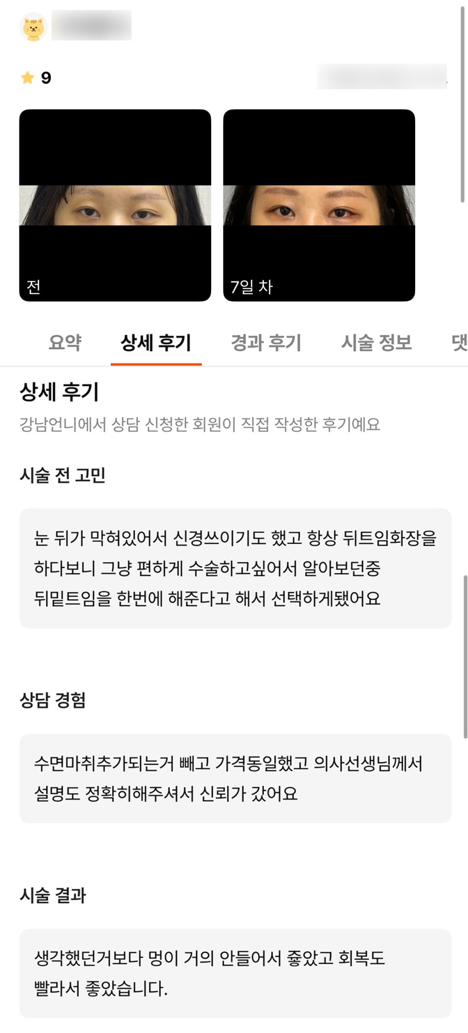 빵트임 후기."멍도 거의 안들고 회복도 빨라서 좋아요!" 관련 이미지 1