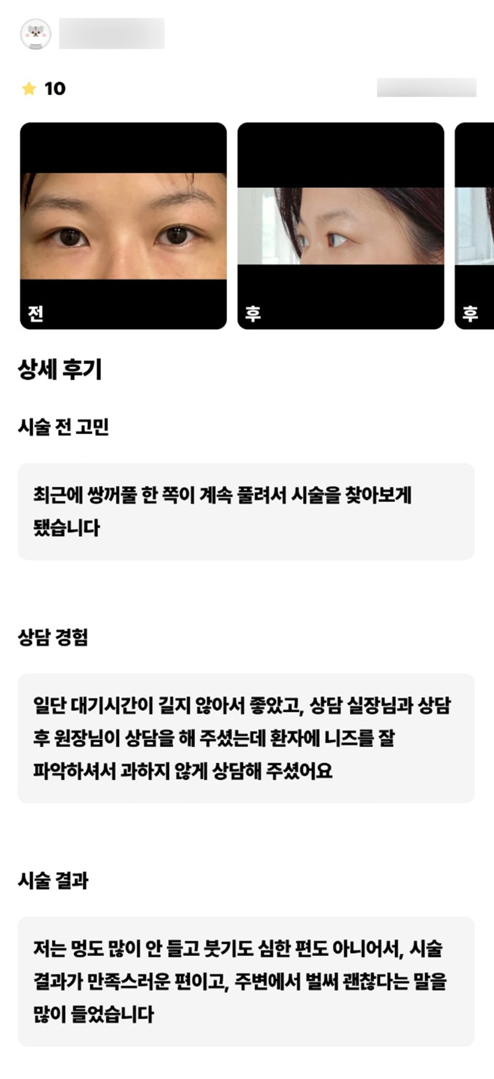 눈재수술 후기."시술 결과가 만족스러운편이고, 주변에서 벌써 괜찮다는 말을 많이 들었습니다 !" 관련 이미지 1