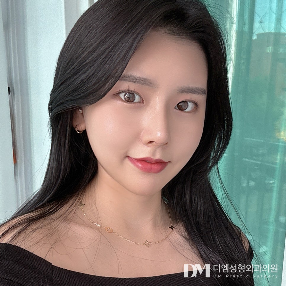 코성형 후 전자담배, 피워도 괜찮을까요? 관련 이미지 6