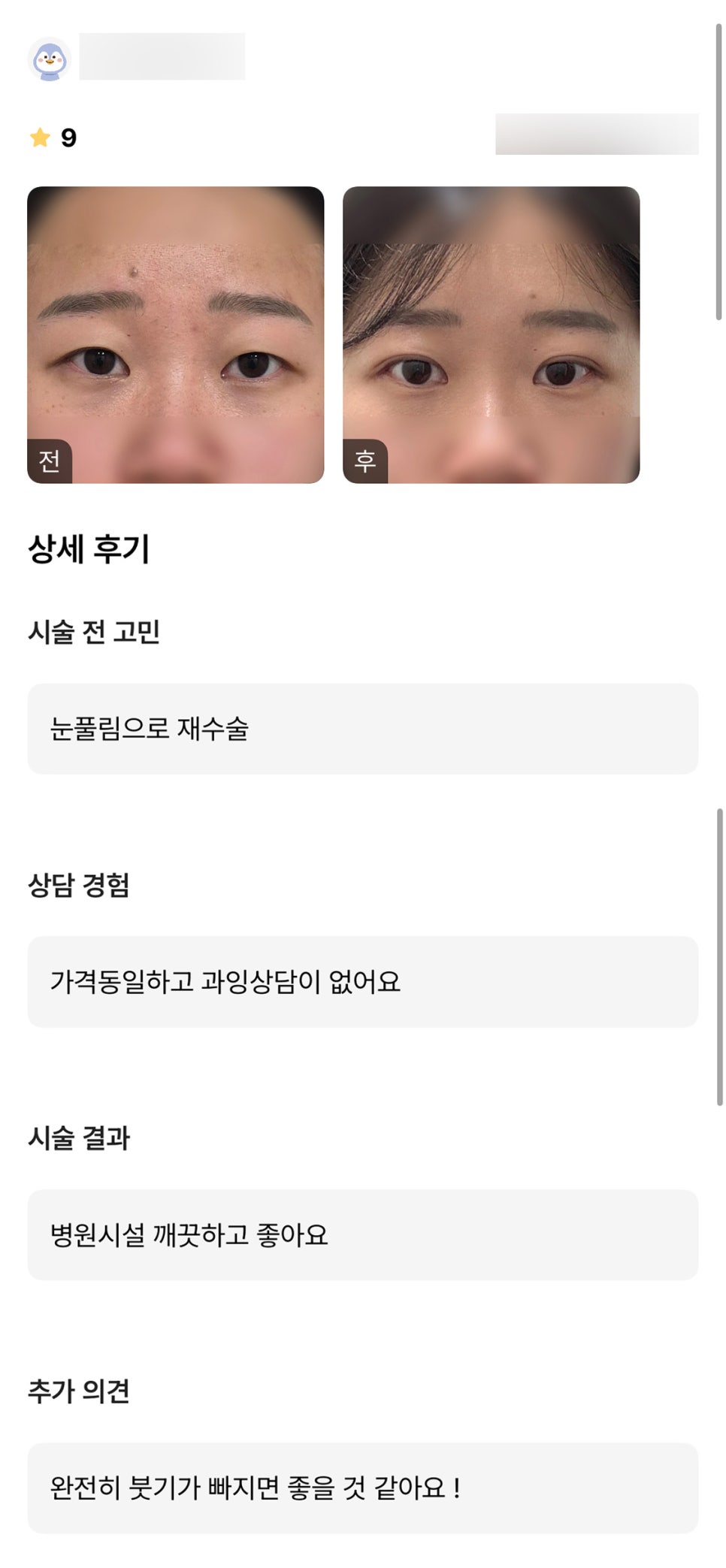 Review of Revision Eye Surgery. "I like that the hospital facilities are good and there was no excessive consultation!" image 1