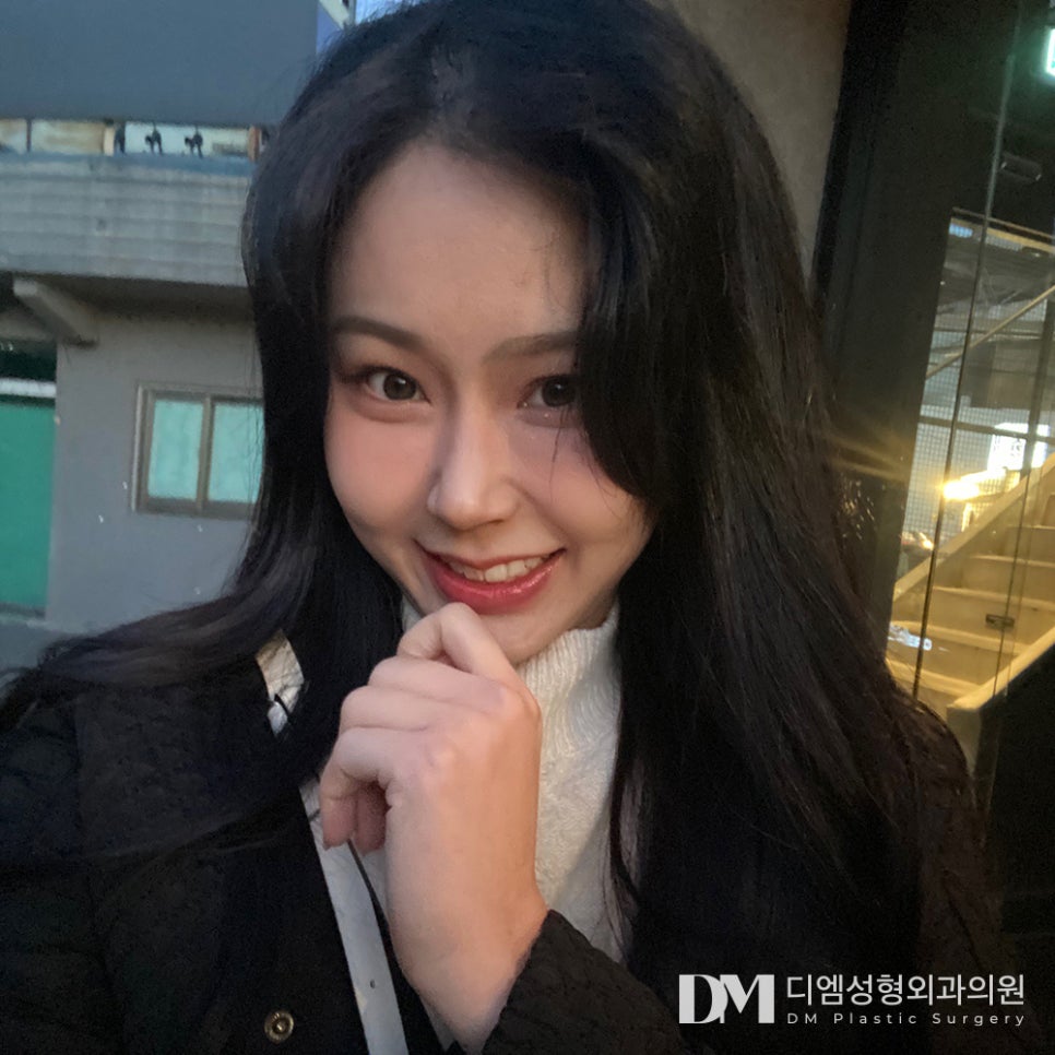 눈밑지방재배치, 동안 효과 뿐 아니라 환한 인상까지 ! 관련 이미지 10