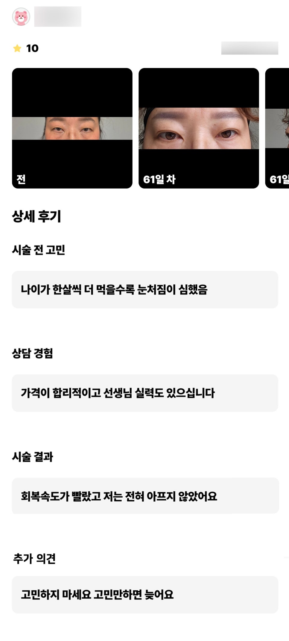 눈성형 후기."고민하지 마세요 고민만 하면 늦어요 " 관련 이미지 1