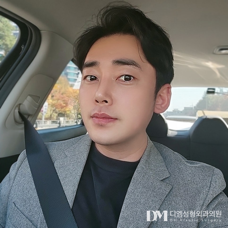 디엠 남자눈매교정/남자눈성형 전후사진, 졸려 보이는 눈이 또렷해지는 변화! 관련 이미지 1