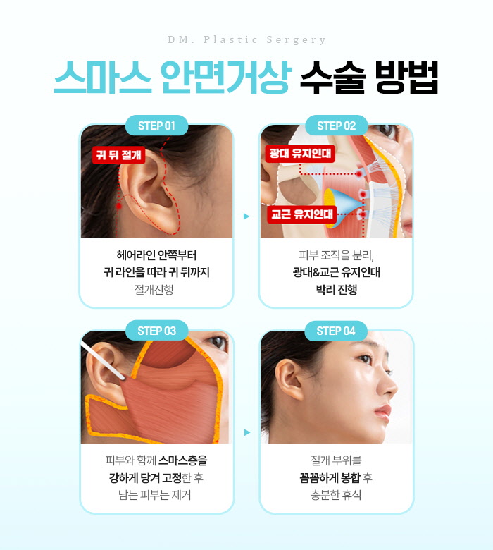 안면거상, 개인별 맞춤형 플랜으로 더욱 높아진 만족도! 관련 이미지 10