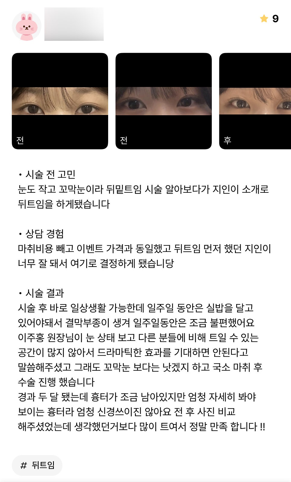빵트임 후기."생각했던 거 보다 많이 트여서 정말 만족 합니다 !!" 관련 이미지 1