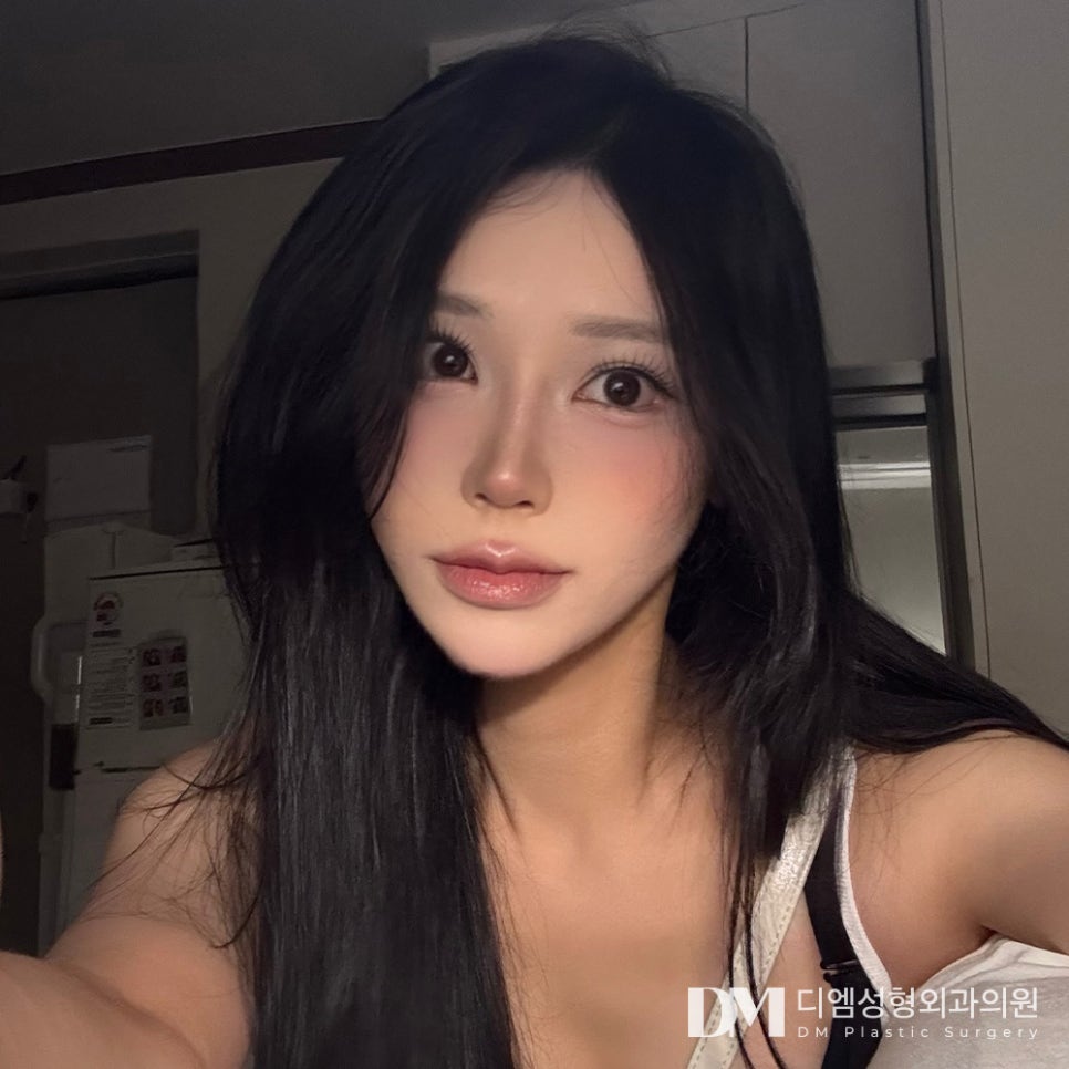 뒤밑트임, 짧아 답답해보이는 눈매라면? 관련 이미지 1