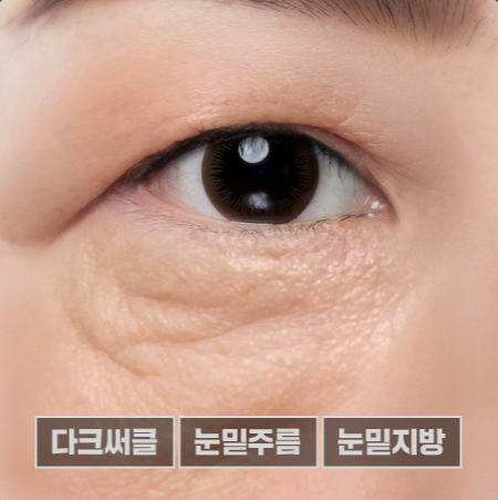 하안검, 밝고 젊어보이는 인상 만들기 관련 이미지 4