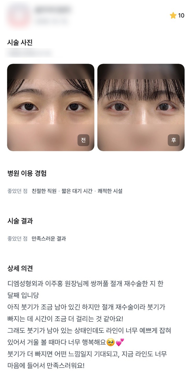 디엠 눈재수술 후기, &ldquo;거울 볼 때마다 너무 행복해요!&rdquo; 관련 이미지 1