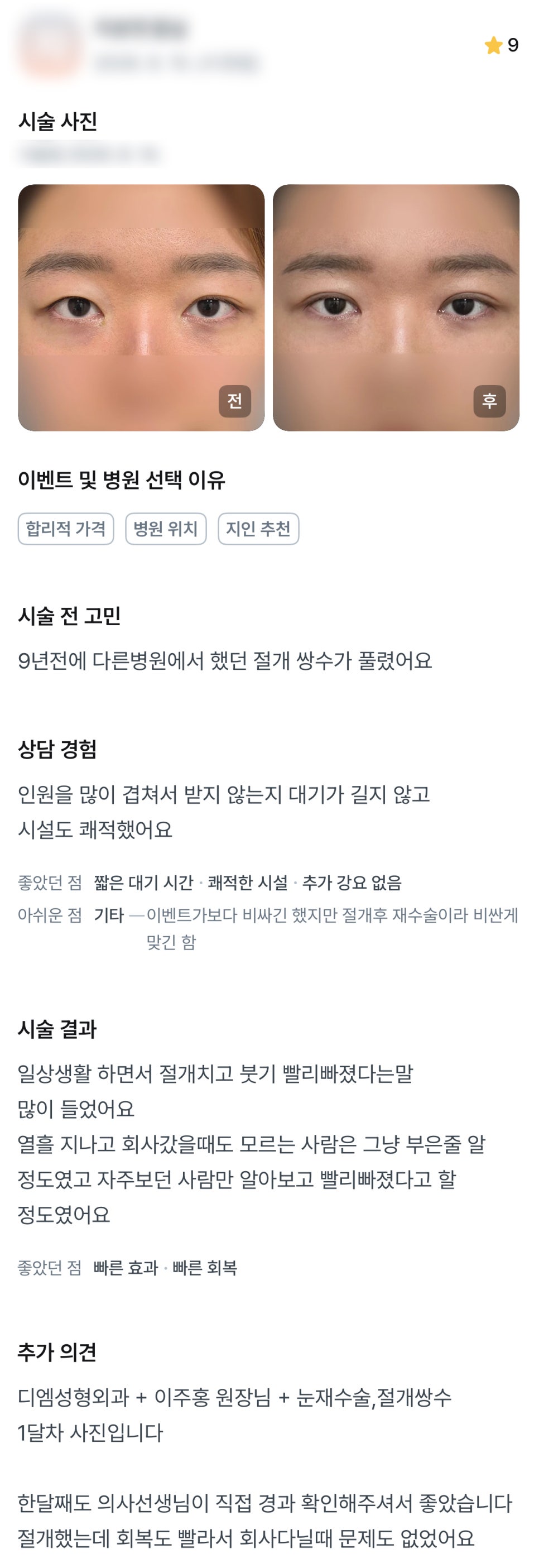 디엠 눈재수술 후기, “절개 수술 후 붓기가 빨리 빠졌어요!” 관련 이미지 1